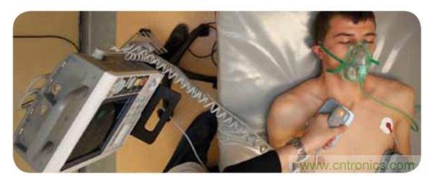 帶電極的醫(yī)院用除顫器。注意，患者身上有外部心電圖或心臟監(jiān)護(hù)儀，從胸部的白色圓片(電極)和導(dǎo)聯(lián)(線)可看出來。