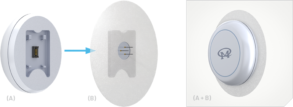 如何使用動態血糖監測設備(CGM)管理糖尿病 如何使用動態血糖監測設備(CGM)管理糖尿病