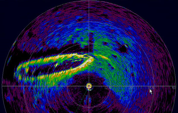 什么是激光雷達以及如何使用它？