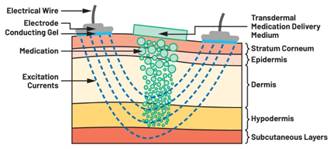  圖5.人體皮膚分層橫截面以及TMD和生物阻抗測量  考慮到生物阻抗分析的無創性，使用兩個金屬電極代表電氣傳感器，連接模擬前端(AFE)電路和患者皮膚。這個金屬與非金屬的接觸點是構成整個電路的另一個關鍵部分，連接了AFE和人體電氣模型。電荷載體（電極中的電子和人體內的離子）之間的相互作用可能對這些傳感器的性能產生重大影響，需要根據每種應用進行具體考慮。首先，金屬與離子溶液接觸的相互作用導致金屬表面附近溶液中離子濃度的局部變化。這種現象會改變電極下方區域的電荷中性，導致金屬周圍的電解質電位與溶液其余部分不同，從而在金屬和電解質主體之間產生一個電位差，即常說的“半電池電位”。其次，注入電流的直流分量會導致電極極化。  表1.各種電極類型和相應的半電池電位  金屬及反應  半電池電位(V)  Al → Al3+ + 3e- Al → Al3+ + 3e-  –1.706 –1.706  Ni → Ni2+ + 2e- Ni → Ni2+ + 2e-  –0.230 -0.230  H2 → 2H+ + 2e- H2 → 2H+ + 2e-  0.000 (by definition) 0.000（根據定義）  Ag + Cl- → AgCl + e- Ag + Cl- → AgCl + e-  +0.223 +0.223  Ag → Ag+ + e- Ag → Ag+ + e-  +0.799 +0.799  Au → Au+ + e- Au → Au+ + e-  +1.680 +1.680  這是一種不良現象，往往導致電極性能下降。這些考量表明，電極也需要定義適當的電氣模型（參見圖6）。我們可以將干電極表示為具有三個串聯元件的電路：一個用于模擬半電池電位(EHC)的直流電源；一個用于模擬金屬和非金屬（人體）之間接觸的RC并聯電池(Rd||Cd)；以及一個用于模擬電極金屬的電阻Rs。